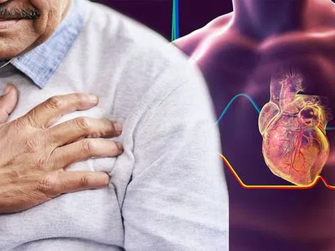 6 căn bệnh do ngồi nhiều mà ra, tiếc rằng bạn vẫn đang kiên trì "nuôi dưỡng" chúng lớn lên