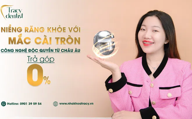 Niềng răng mắc cài tròn - xu hướng chỉnh nha năm 2024